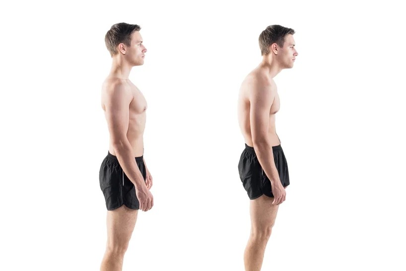 Posture Correction Guide